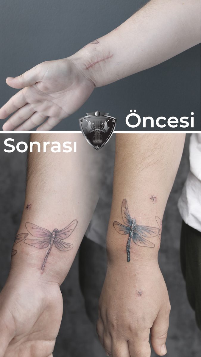 Yusufçuk Cover Up